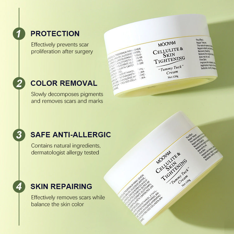 Effective stretch mark treatment for all skin types